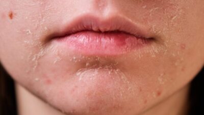rekomendasi skincare kulit kering